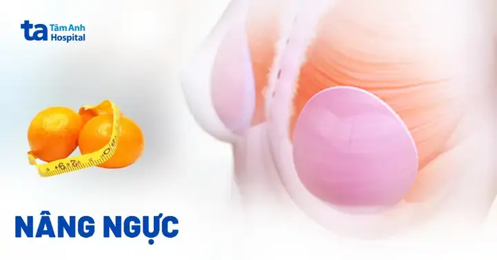 Người Ta Nuôi Cá Mập