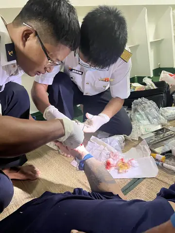 Cá Chình Biển Cắn Cá Chình Biển Cắn
