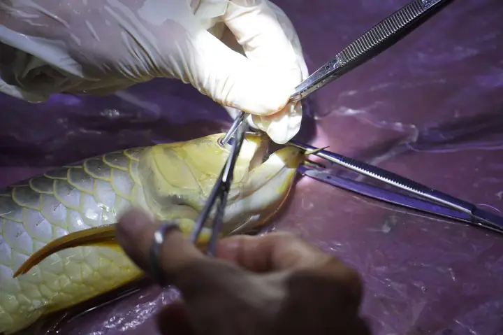 Phẫu Thuật Mắt Cá Rồng