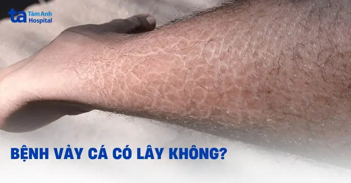 Vảy Cá Có Chức Năng Gì